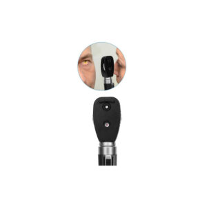 Ophthalmoscope – Retinal Examination Instrument
